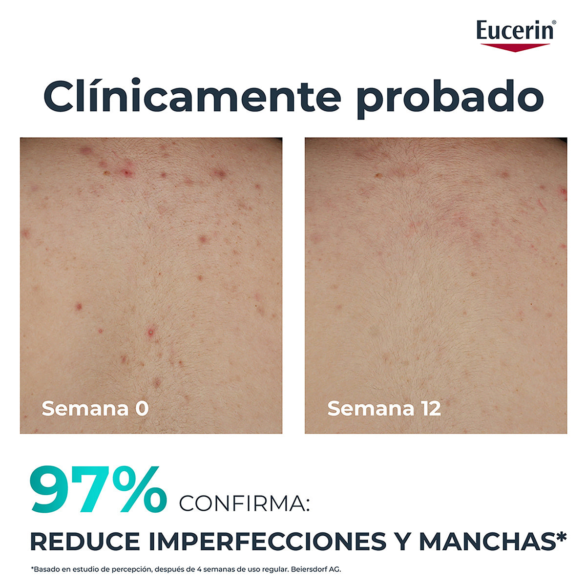 Dermo Pure Oil Control Crema 200Ml Eucerin